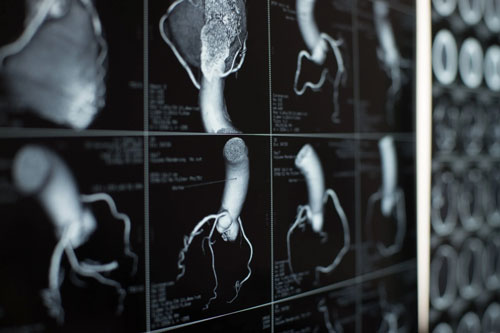 Diagnostic procedures
