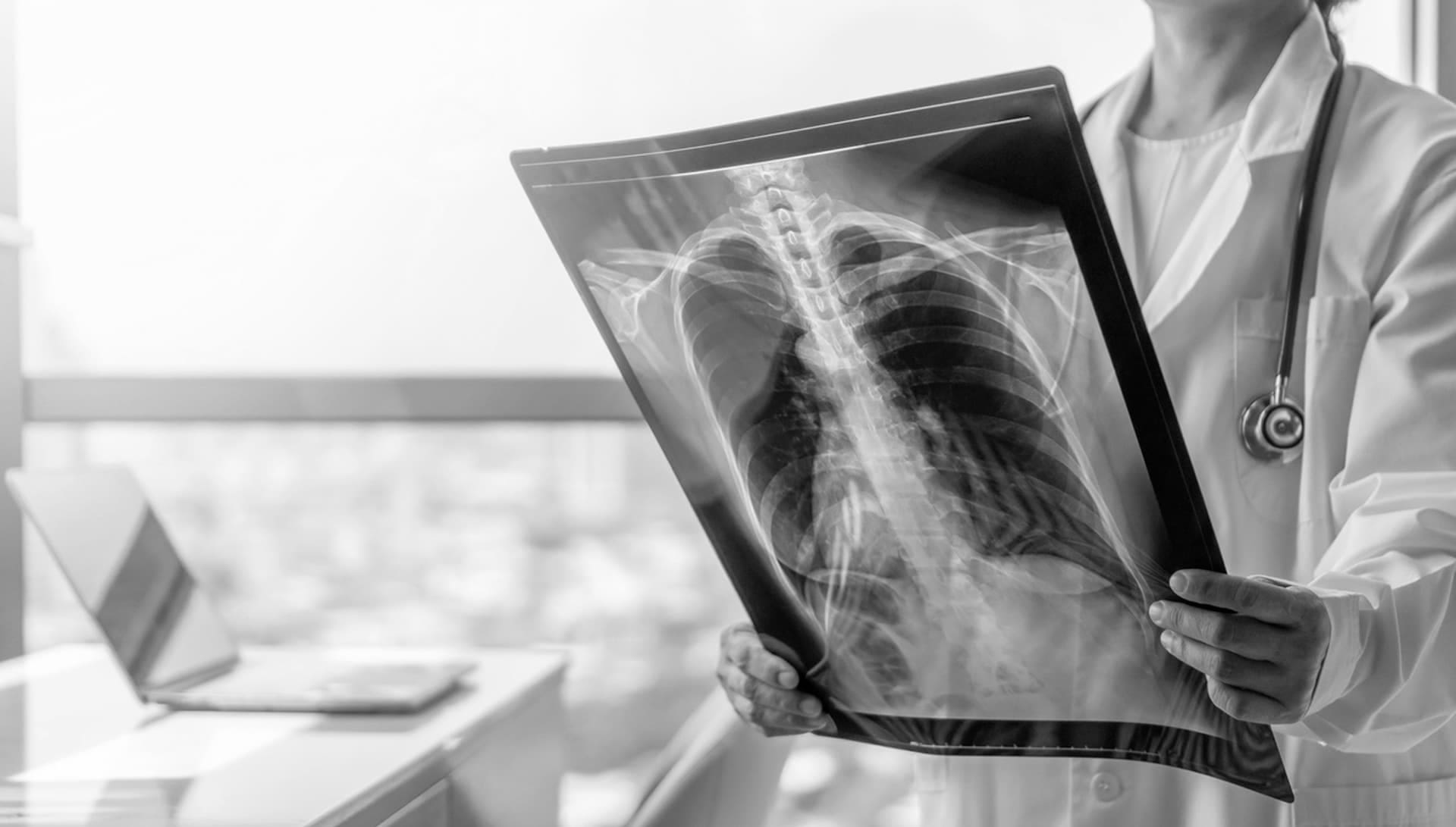 pain management in brentwood - x rays